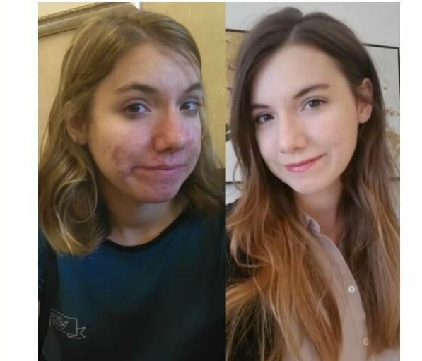 20 vs 23 20 vs 23