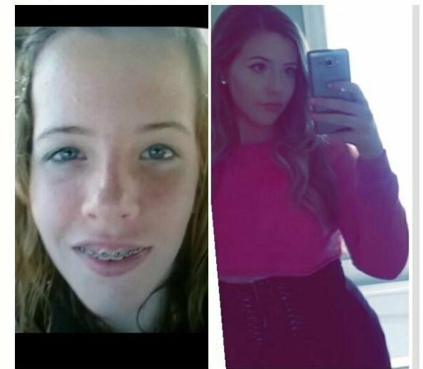 14 vs 20 14 vs 20